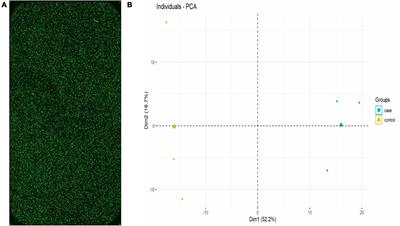 Long non-coding RNA expression in PBMCs of patients with active pulmonary tuberculosis